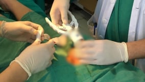 Cắt bao quy đầu 'chui' - Hậu quả khôn lường cho sức khỏe nam giới