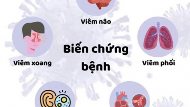 Các biến chứng của bệnh cúm