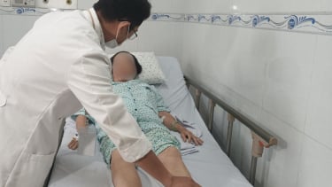 Suýt đoạn chi vì huyết khối tĩnh mạch chậu – đùi cấp