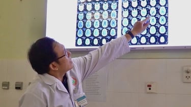 Bệnh viện Đa khoa Cà Mau can thiệp thành công ca phình mạch não
