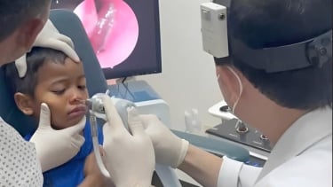 Phát hiện đỉa trong đường thở của bệnh nhi 5 tuổi
