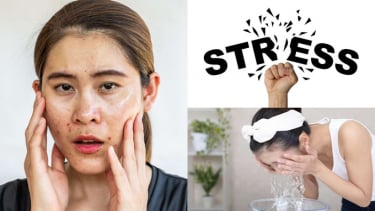 5 thói quen khiến da dầu càng thêm dầu