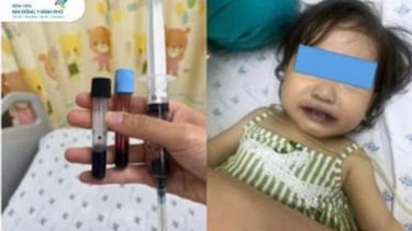 TP. Hồ Chí Minh: Cấp cứu kịp thời cứu sống một trẻ tím tái nặng do Methemoglobine máu