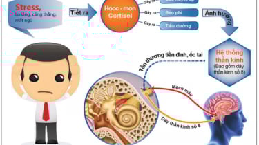 Rối loạn tiền đình có chữa khỏi được không?