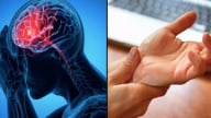 Dấu hiệu cảnh báo đột quỵ trước một tuần tuyệt đối đừng bỏ qua