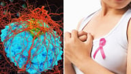 Tỷ lệ sống sót của 4 loại ung thư này gần như là 100%, bao gồm cả ung thư vú, thật đáng tiếc nếu từ bỏ điều trị 