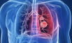Thông tin Y khoa: Bệnh do amian (Tên Tiếng Anh: Asbestos-induced diseases)