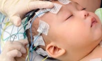 Viêm màng não mủ sơ sinh: Các xét nghiệm chẩn đoán