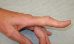 Thông tin Y khoa: Dị dạng, biến dạng (Tên Tiếng Anh: Deformity)