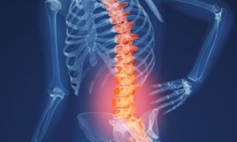 Thông tin Y khoa: Giải ép ống tủy sống (Tên Tiếng Anh: Decompression, spinal canal)