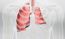 Thông tin Y khoa: Xẹp phổi (Tên Tiếng Anh: Atelectasis)