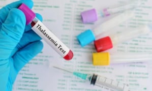 Kiến thức về tan máu bẩm sinh (thalassemia): Nguyên nhân, biểu hiện và cách điều trị 