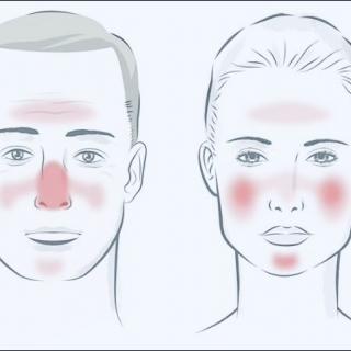 Thông tin Y khoa: Đỏ mặt (Tên Tiếng Anh: Blushing)