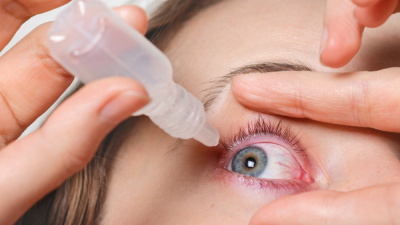 Một số thuốc nhỏ mắt trị đau mắt đỏ hiệu quả