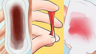 Dấu hiệu ung thư cổ tử cung: Những triệu chứng cần lưu ý để phát hiện sớm