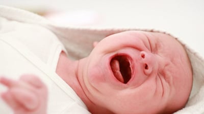 Viêm màng não mủ: Nguyên nhân, chẩn đoán và cách điều trị 