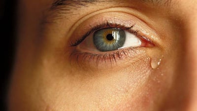 Viêm túi lệ: Nguyên nhân, triệu chứng và cách điều trị