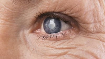 Glôcôm góc đóng nguyên phát: Bệnh nguy hiểm cần phải điều trị ngay 