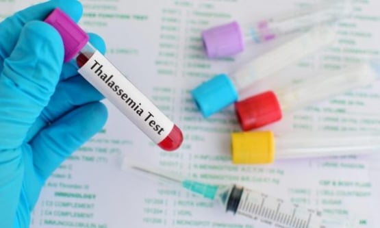 Bệnh tan máu bẩm sinh (Thalassemia): Nguyên nhân, biểu hiện và cách điều trị 