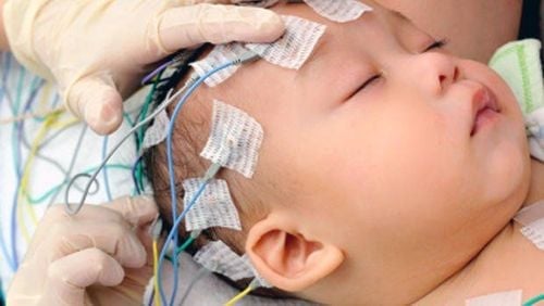Viêm màng não mủ sơ sinh: Các xét nghiệm chẩn đoán